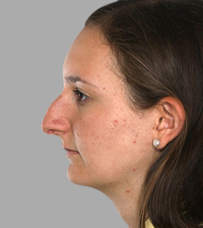 bna plastic surgery