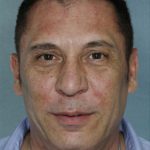 Facelift Before & After Patient #9226