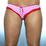 Liposuction Before & After Patient #8604