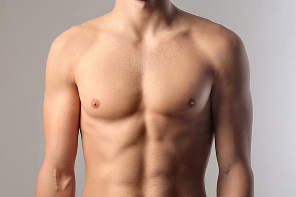 Gynecomastia