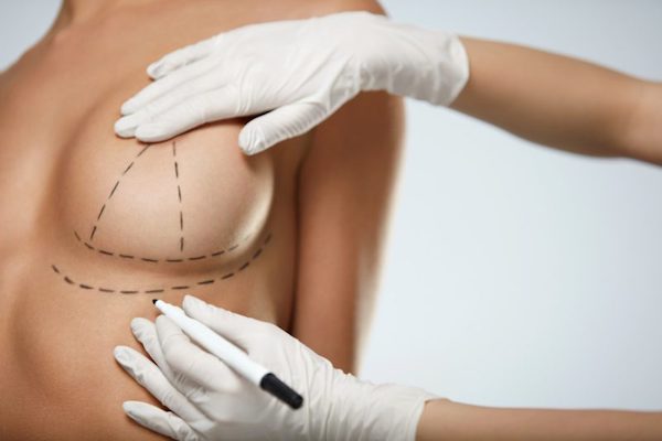 Breast Reconstruction New York